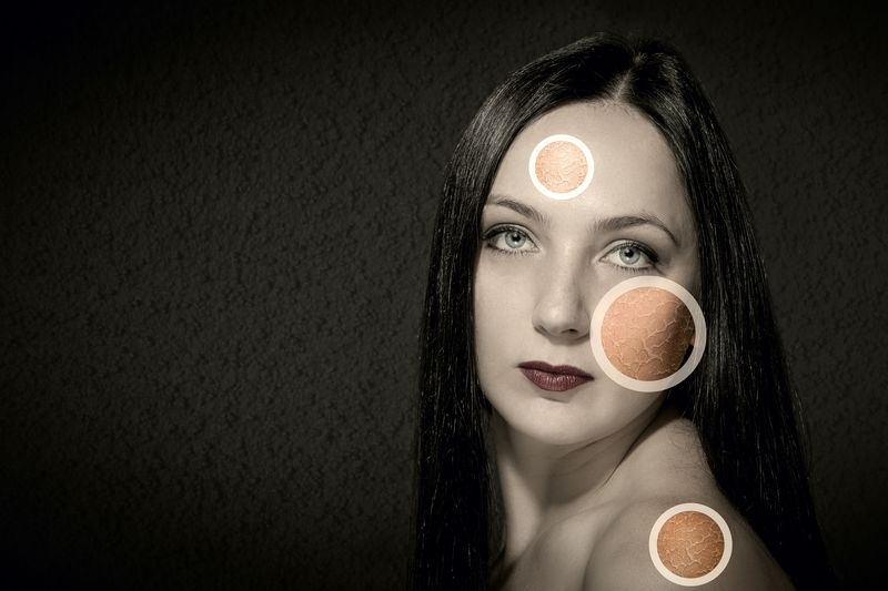 Влияние инфламмасом на процессы старения кожи