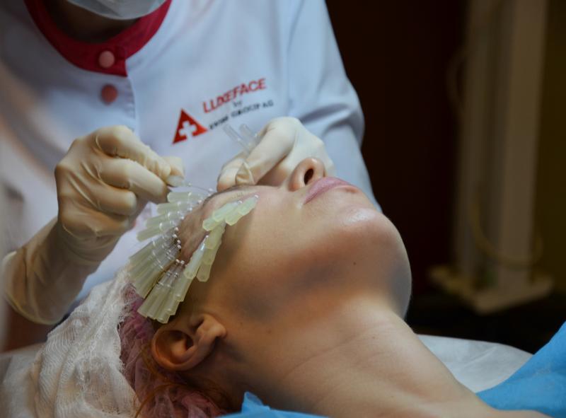 LUXEFACE – нитевой лифтинг как искусство