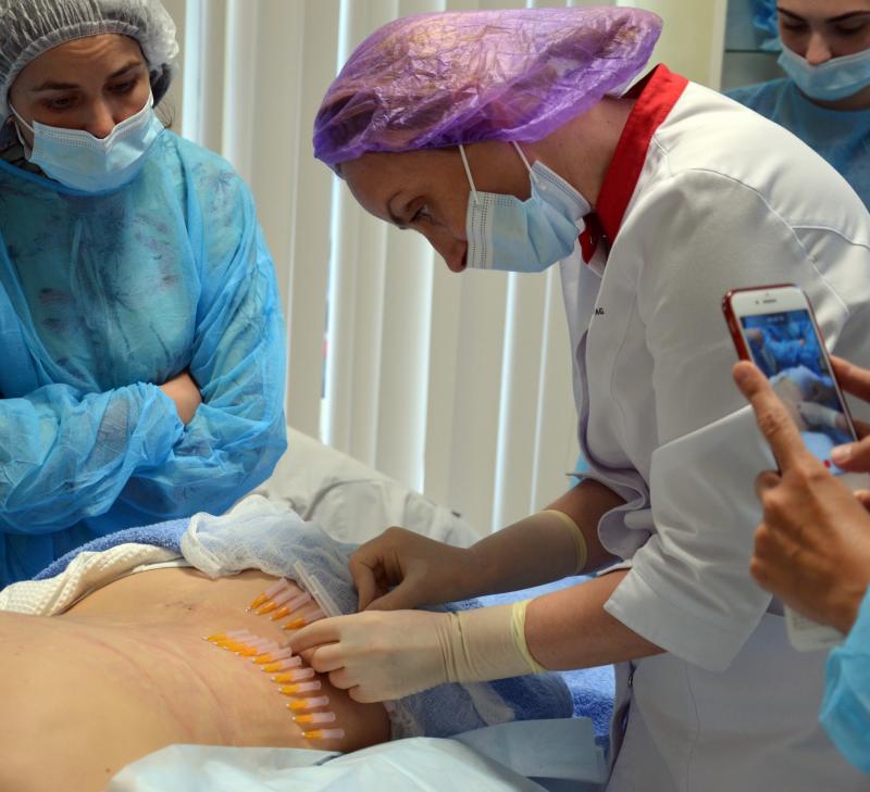 Врачам показали новейшие схемы нитевого омоложения тела