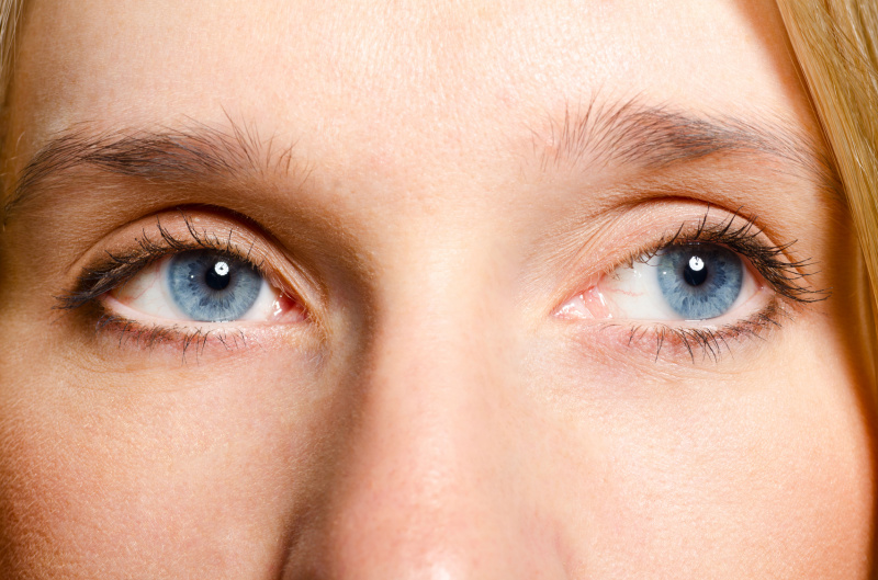 Птоз после ботокса: что делать, если опустились веки?