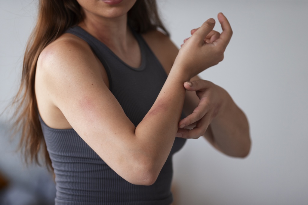 Симптомы и проявления дерматита